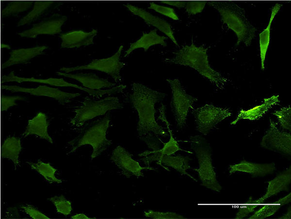 HD Antibody in Immunocytochemistry (ICC/IF)