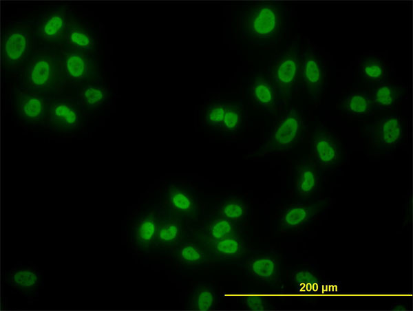 HDAC1 Antibody in Immunocytochemistry (ICC/IF)