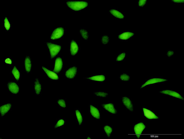 HDAC2 Antibody in Immunocytochemistry (ICC/IF)