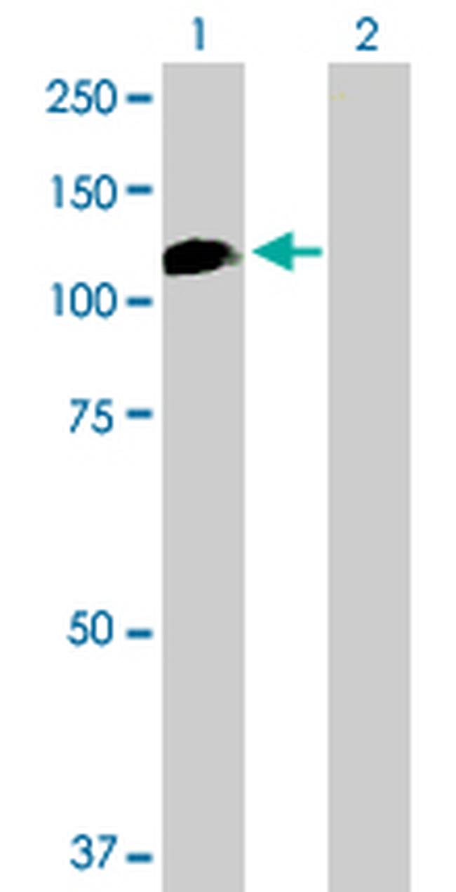 HELLS Antibody in Western Blot (WB)