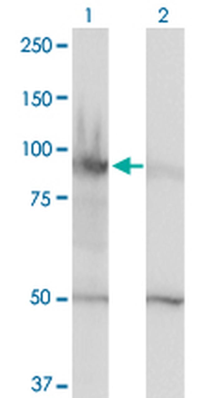 HELLS Antibody in Western Blot (WB)