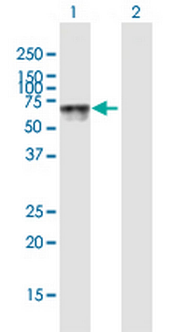 HEXA Antibody in Western Blot (WB)