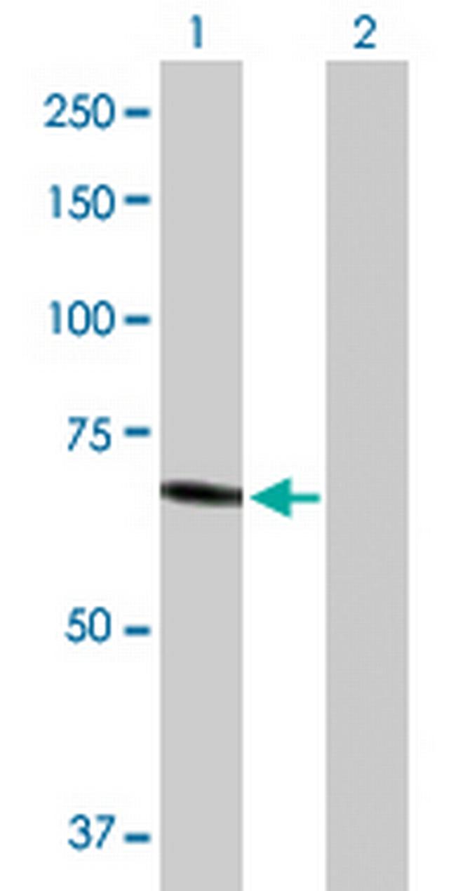 HEXA Antibody in Western Blot (WB)