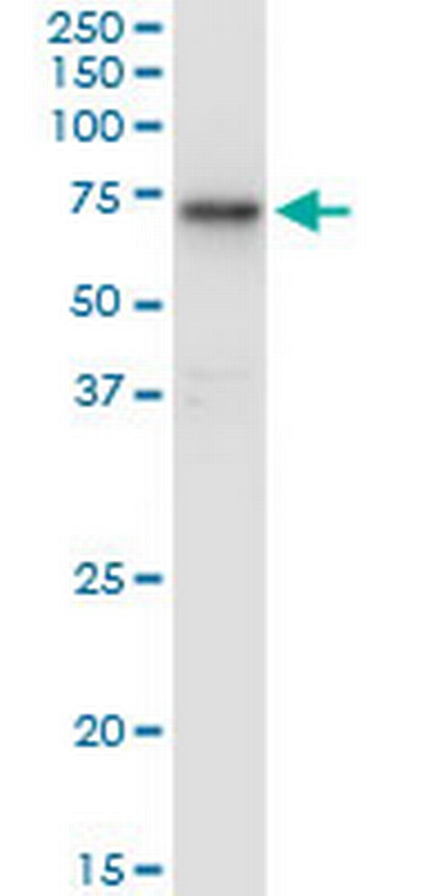 HEXA Antibody in Western Blot (WB)