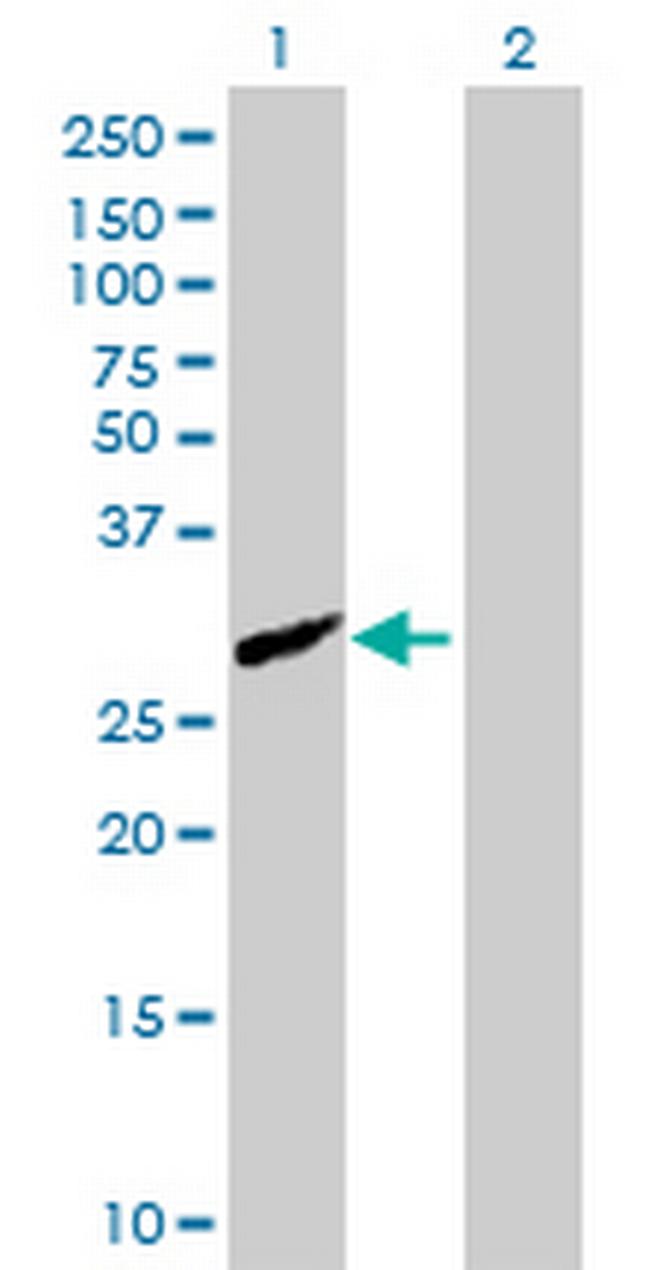 CFHR2 Antibody in Western Blot (WB)