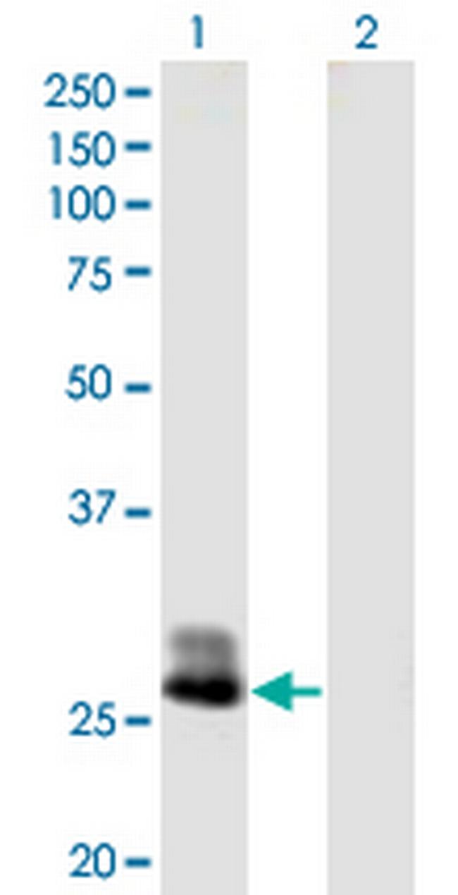 CFHR2 Antibody in Western Blot (WB)