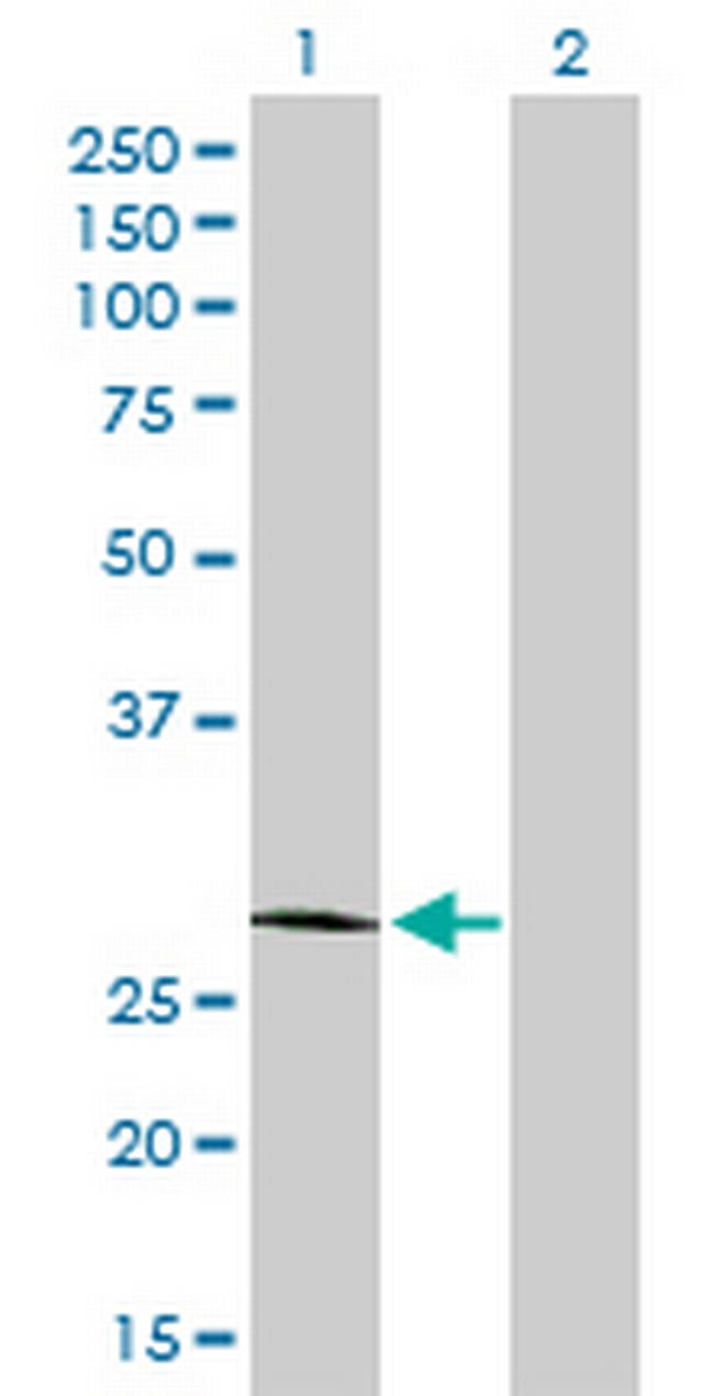 CFHR2 Antibody in Western Blot (WB)