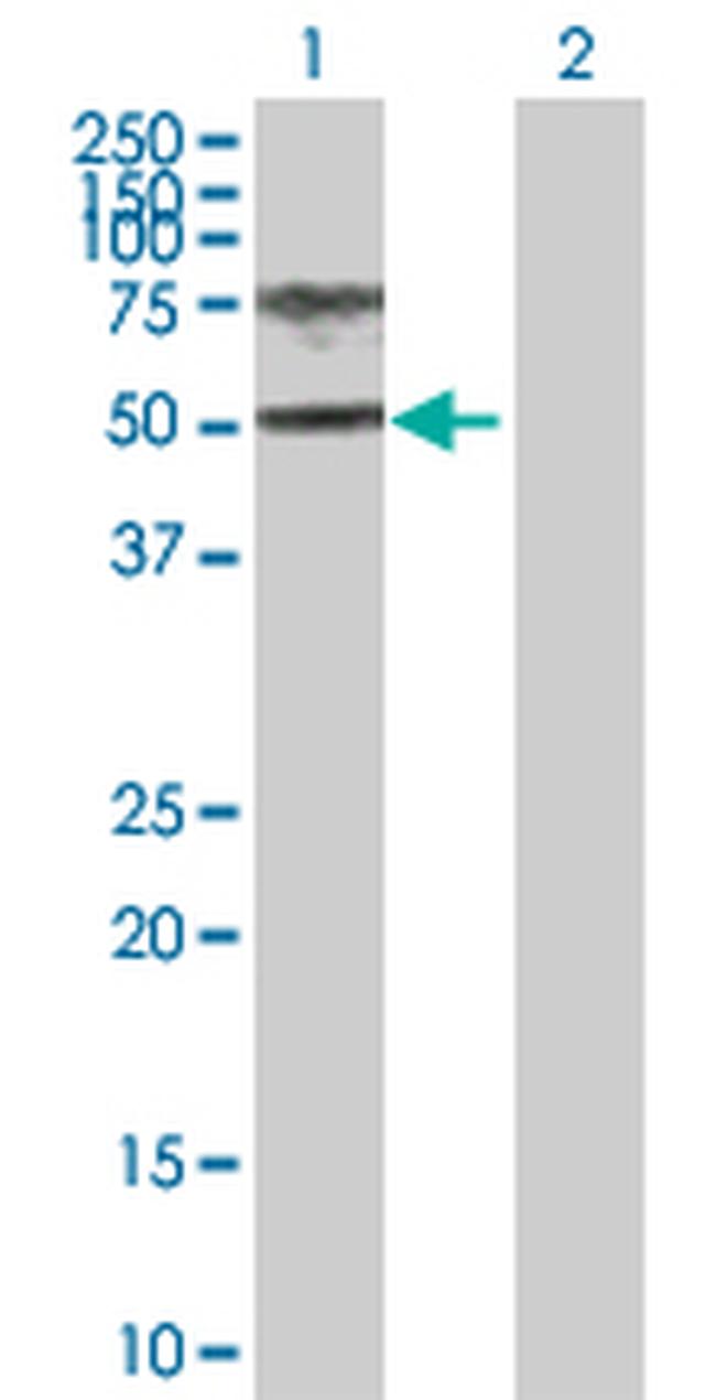 HGD Antibody in Western Blot (WB)