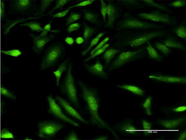 HGD Antibody in Immunocytochemistry (ICC/IF)