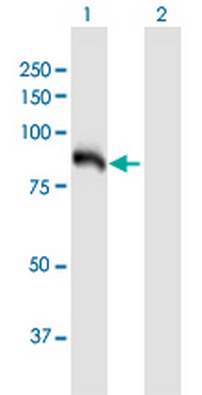 HK3 Antibody in Western Blot (WB)