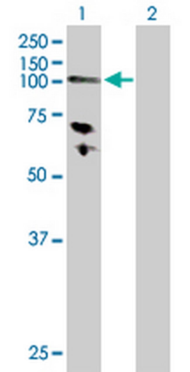 HK3 Antibody in Western Blot (WB)