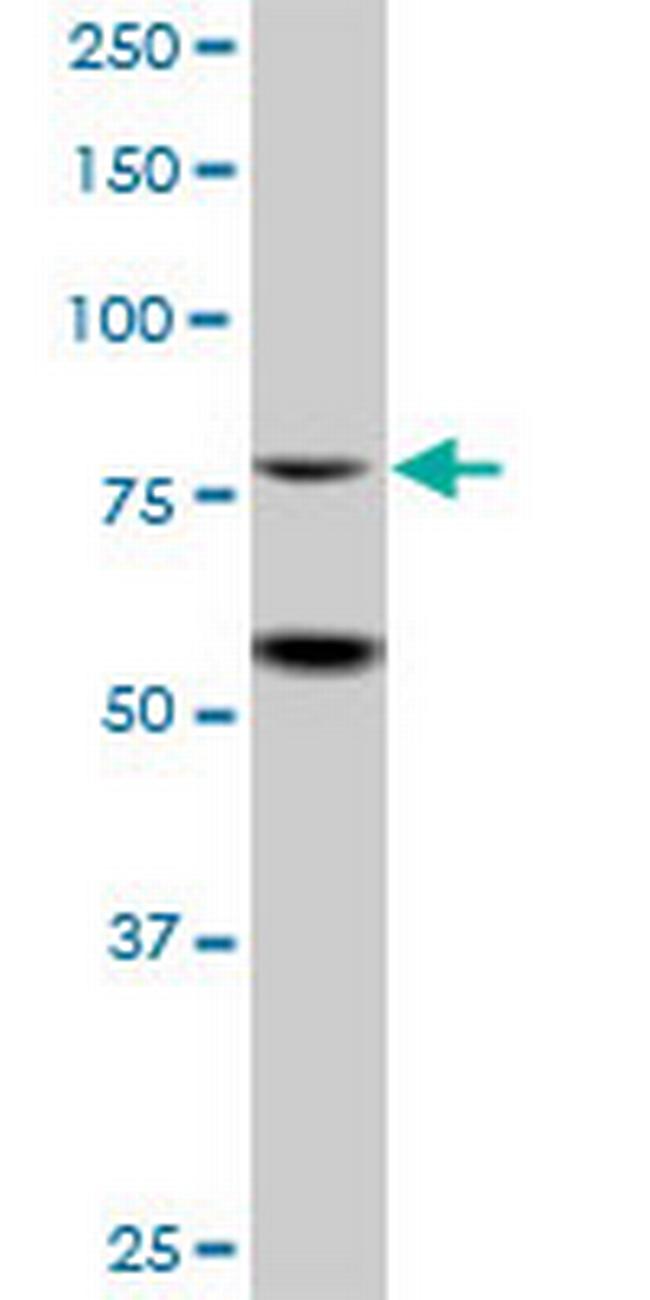 ZBTB48 Antibody in Western Blot (WB)