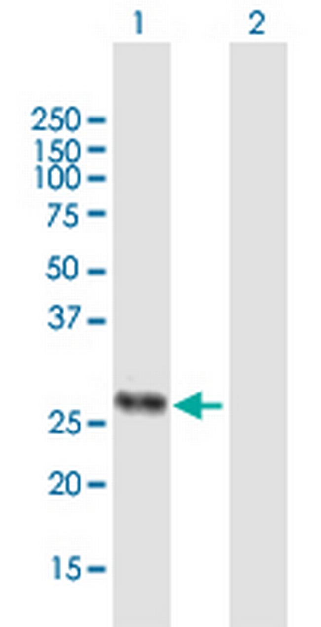 HLA-DMA Antibody in Western Blot (WB)