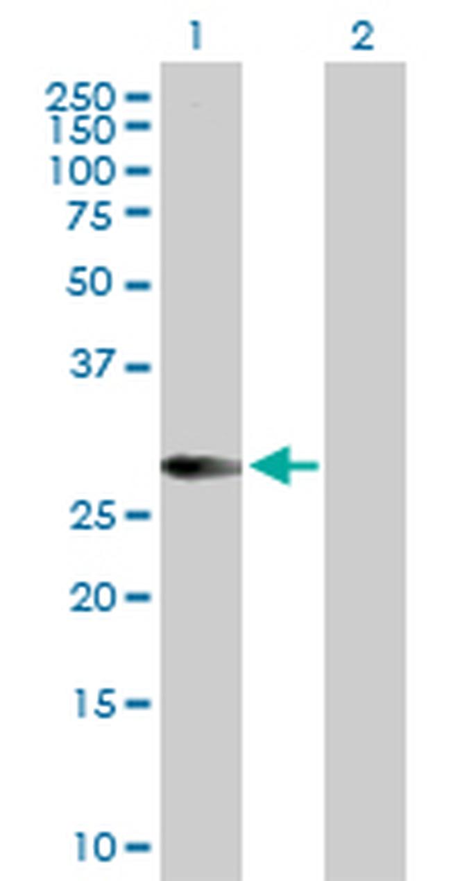 HLA-DMA Antibody in Western Blot (WB)