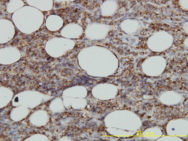 HLA-DMA Antibody in Immunohistochemistry (Paraffin) (IHC (P))