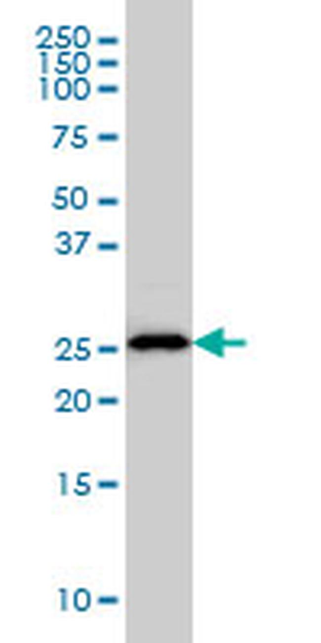 HLA-DMA Antibody in Western Blot (WB)