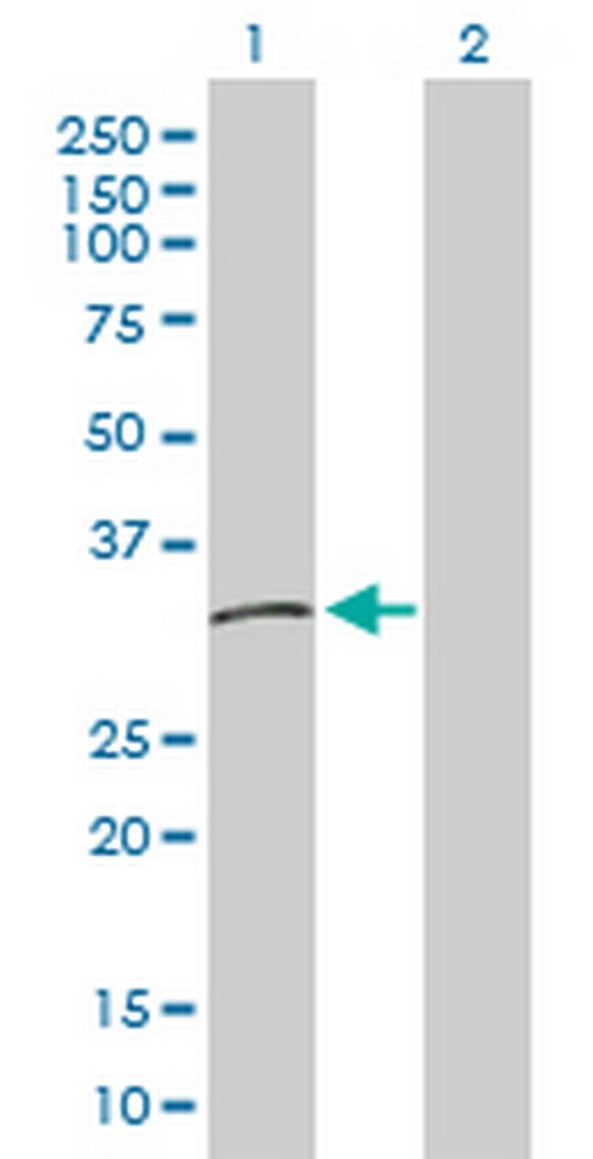 HLA-DMB Antibody in Western Blot (WB)