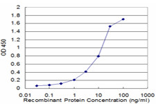 HLA-DMB Antibody in ELISA (ELISA)