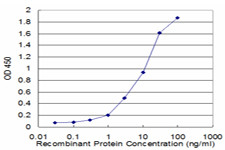 HLA-DMB Antibody in ELISA (ELISA)