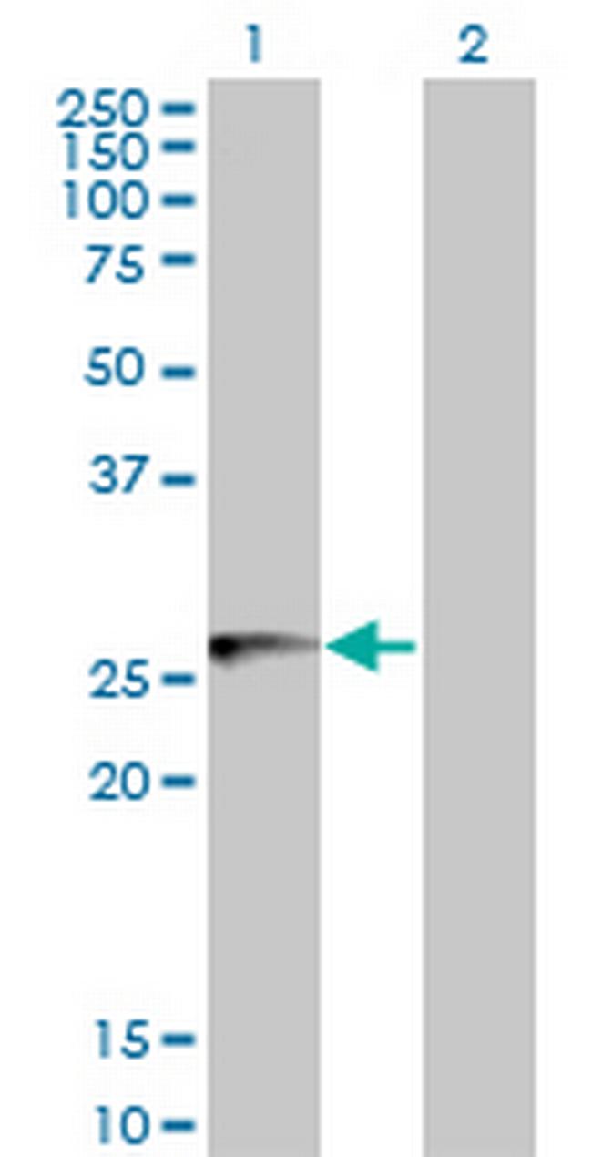 HLA-DMB Antibody in Western Blot (WB)