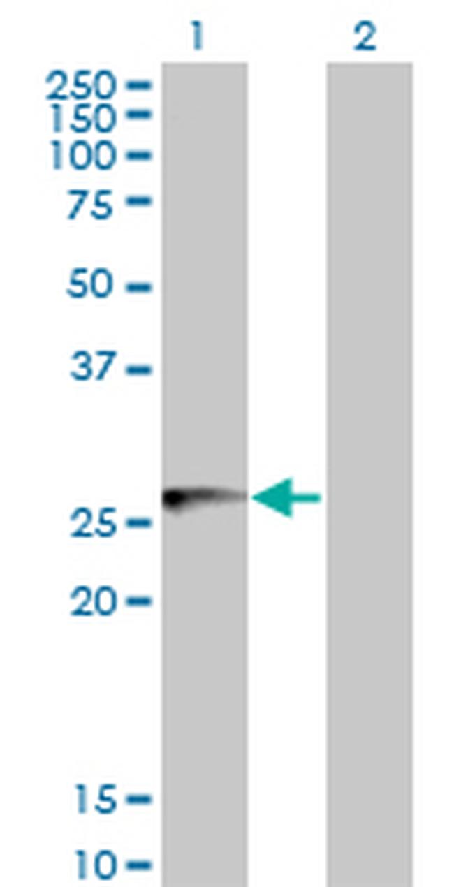 HLA-DMB Antibody in Western Blot (WB)