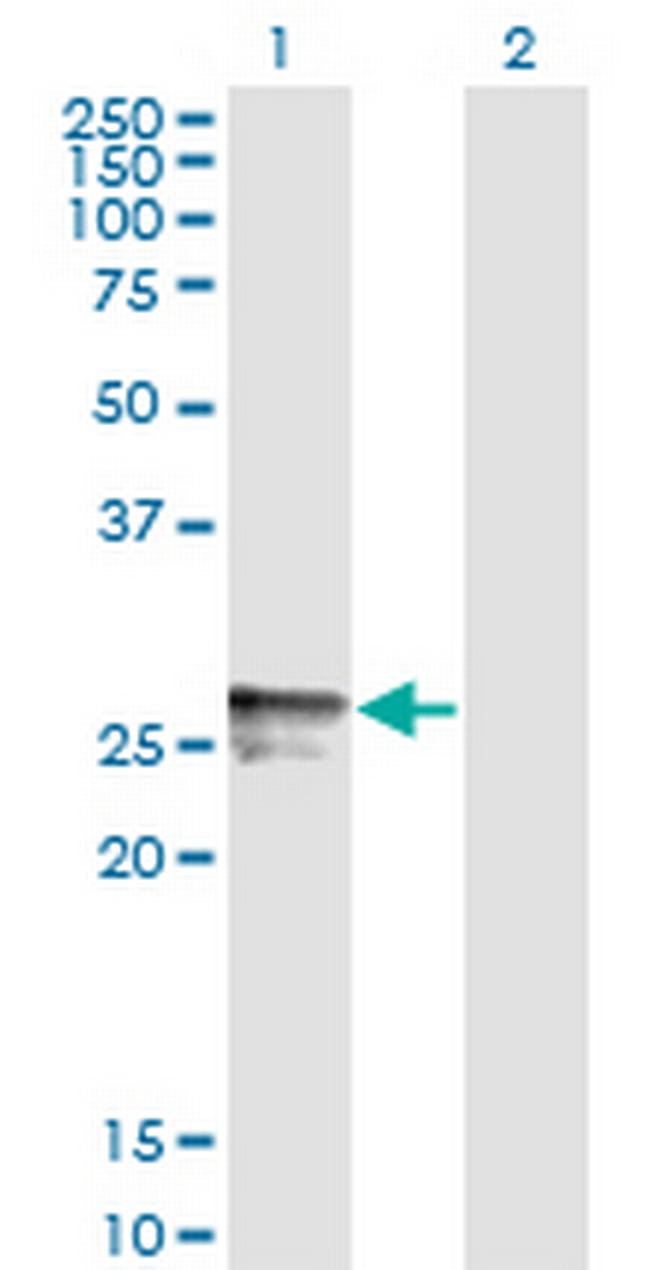 HLA-DMB Antibody in Western Blot (WB)