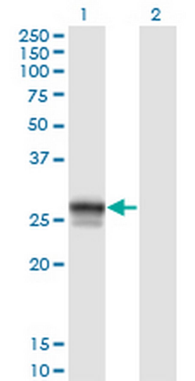 HLA-DMB Antibody in Western Blot (WB)