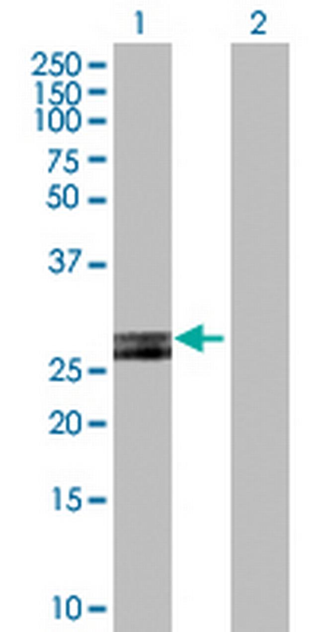 HLA-DOB Antibody in Western Blot (WB)