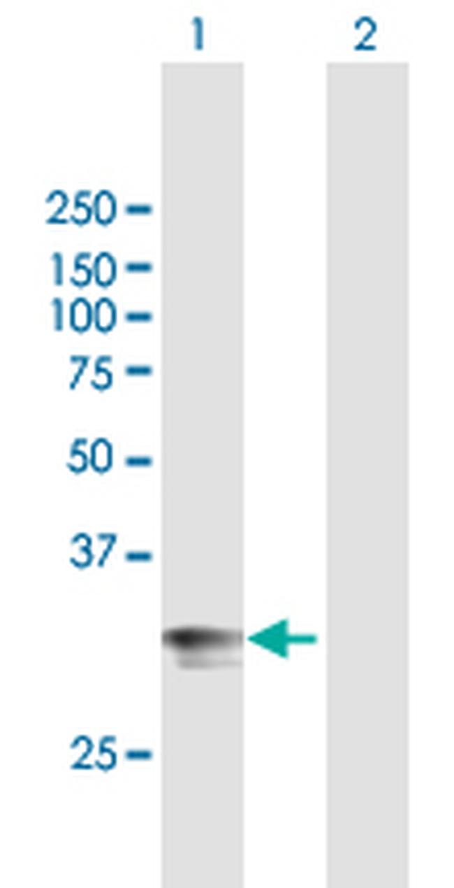 HLA-DPA1 Antibody in Western Blot (WB)