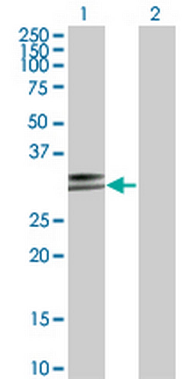 HLA-DPA1 Antibody in Western Blot (WB)