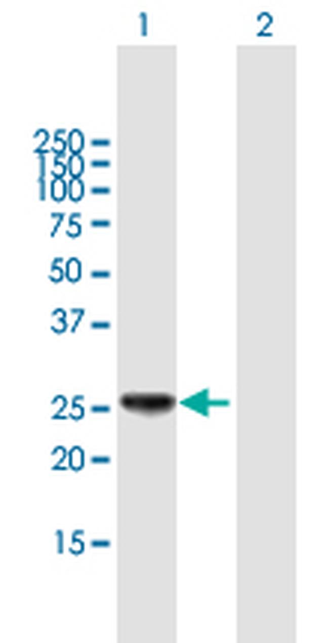 HLA-DPB1 Antibody in Western Blot (WB)