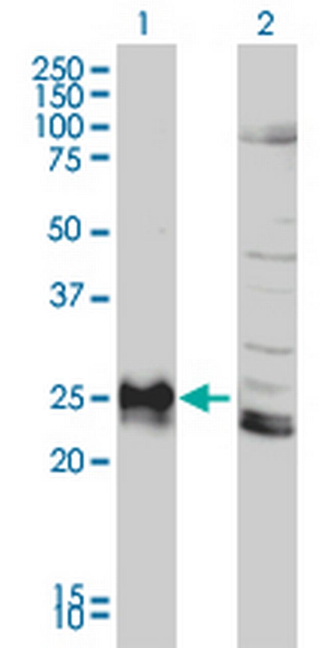HLA-DPB1 Antibody in Western Blot (WB)