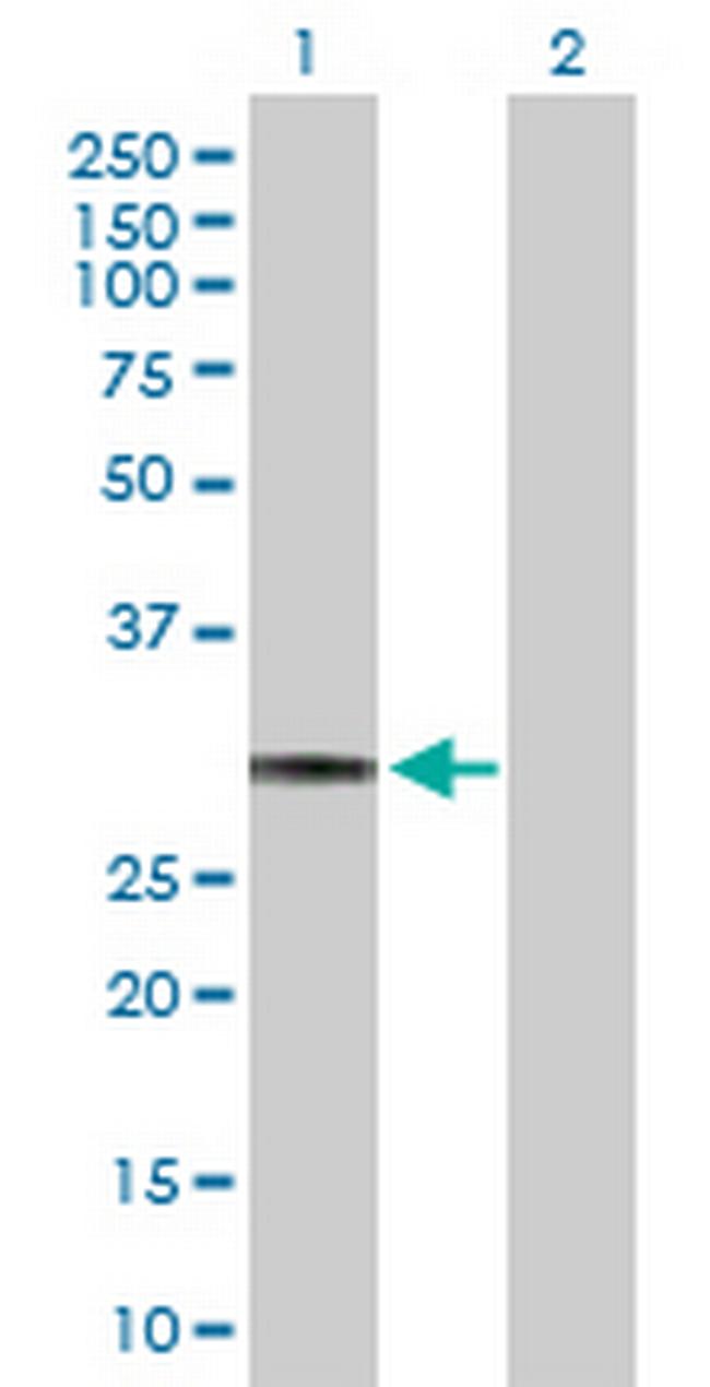 HLA-DQA1 Antibody in Western Blot (WB)