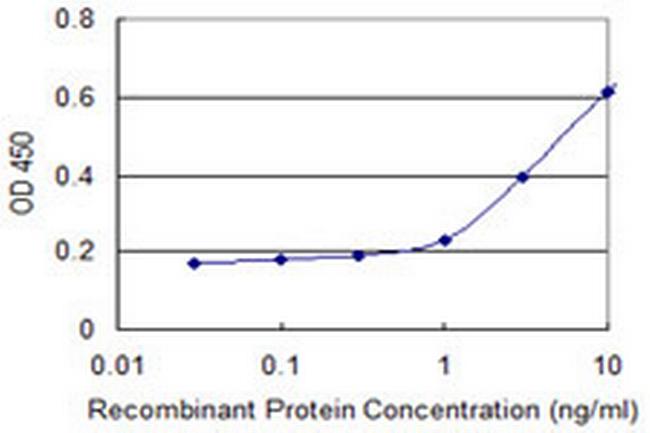 HLA-DQB1 Antibody in ELISA (ELISA)