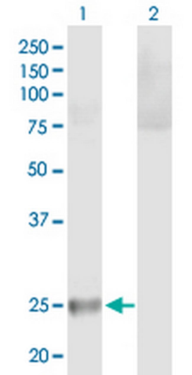 HLA-DQB2 Antibody in Western Blot (WB)