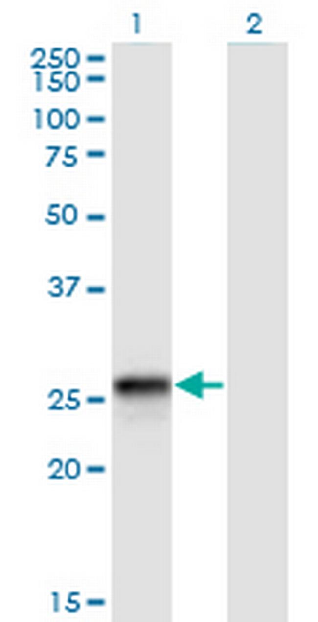 HLA-DQB2 Antibody in Western Blot (WB)