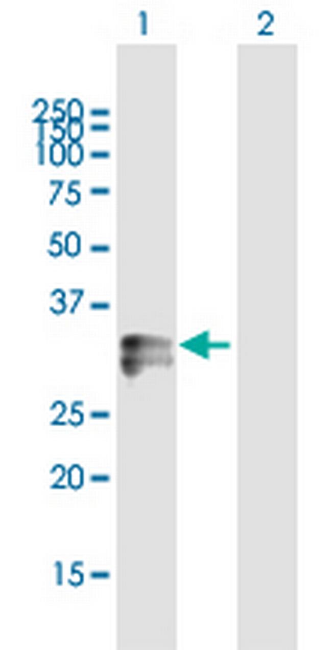 HLA-DRA Antibody in Western Blot (WB)