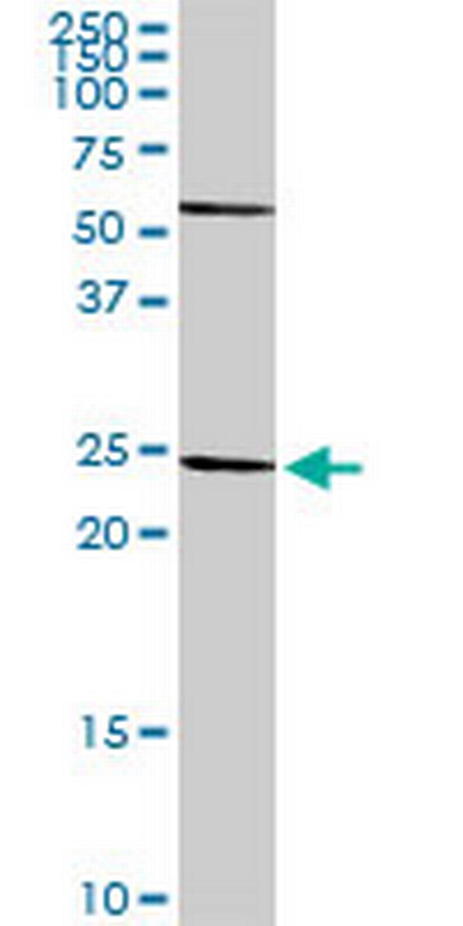 HLA-DRA Antibody in Western Blot (WB)