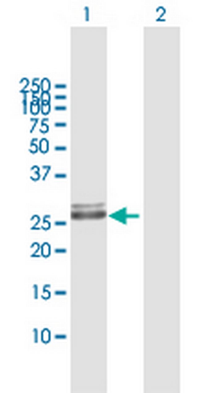 HLA-DRB1 Antibody in Western Blot (WB)