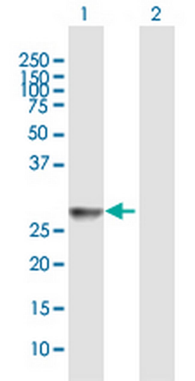 HLA-DRB3 Antibody in Western Blot (WB)