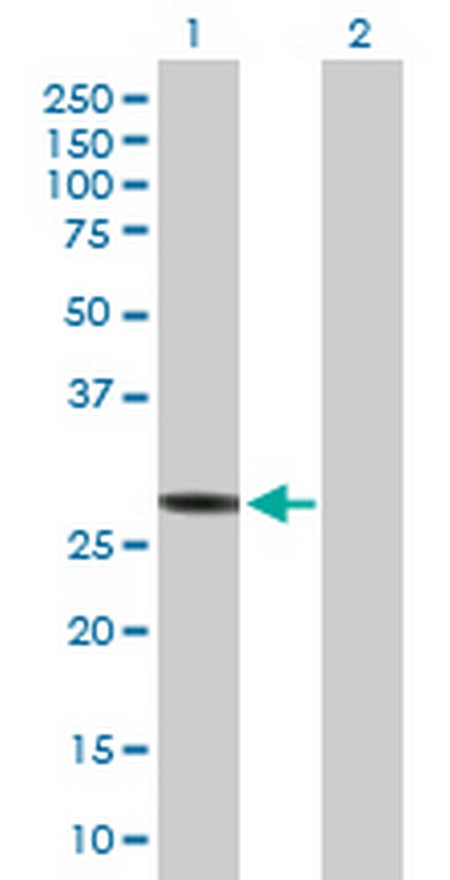 HLA-DRB3 Antibody in Western Blot (WB)