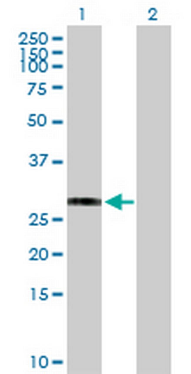 HLA-DRB3 Antibody in Western Blot (WB)