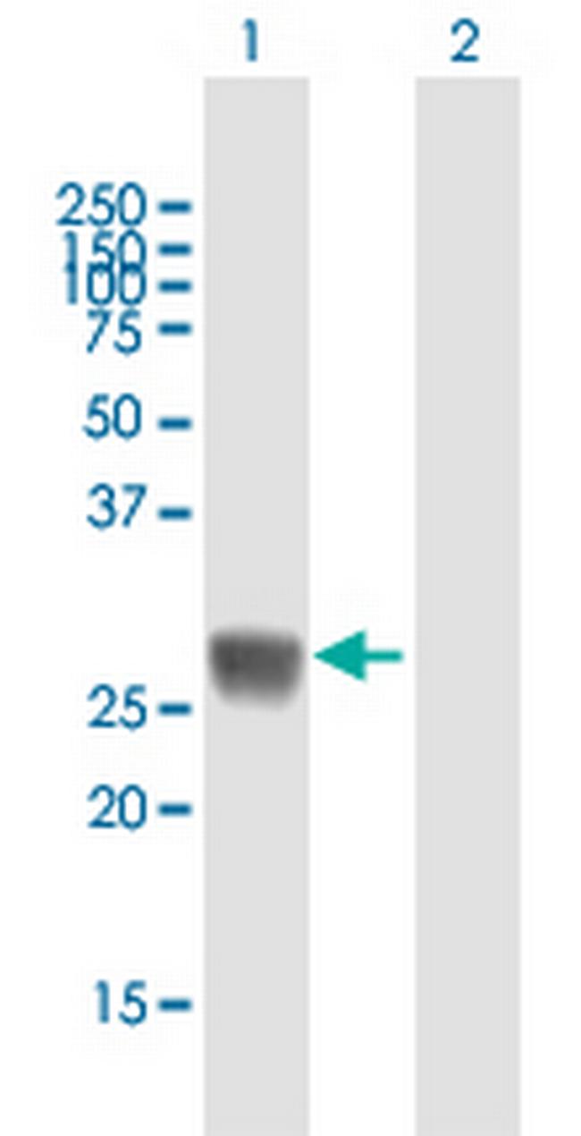 HLA-DRB5 Antibody in Western Blot (WB)