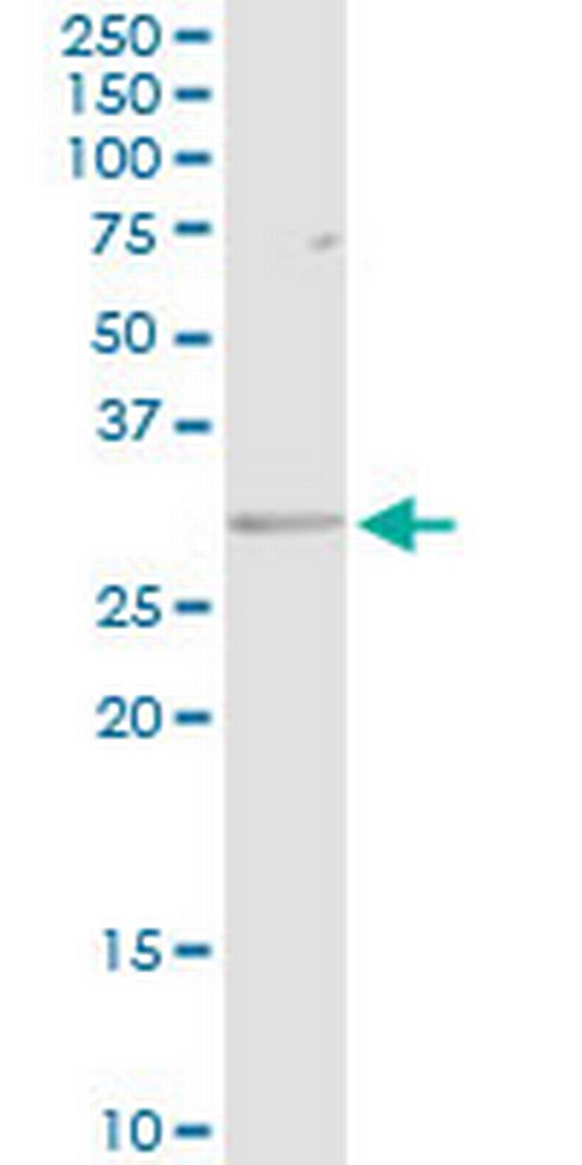 HLA-DRB5 Antibody in Western Blot (WB)