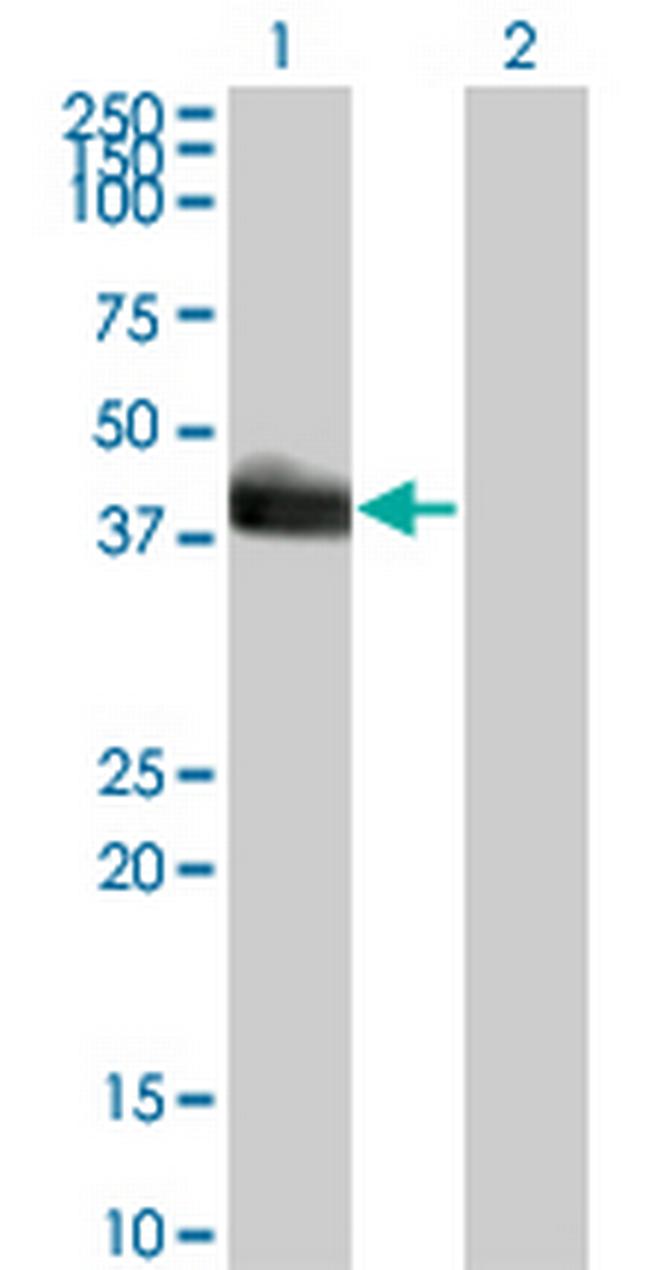 HLF Antibody in Western Blot (WB)