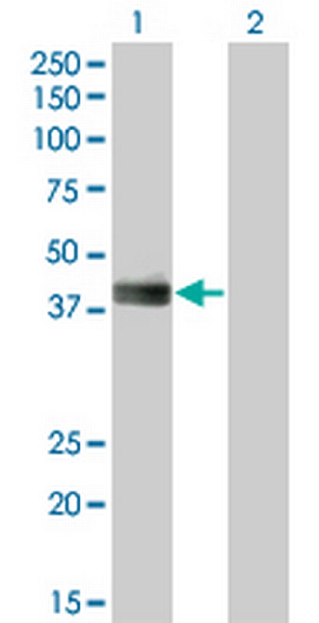 HLF Antibody in Western Blot (WB)
