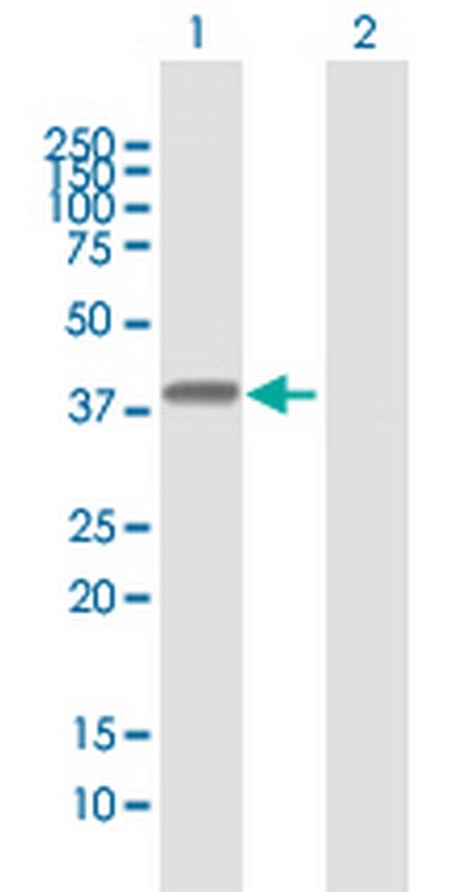HLA-E Antibody in Western Blot (WB)