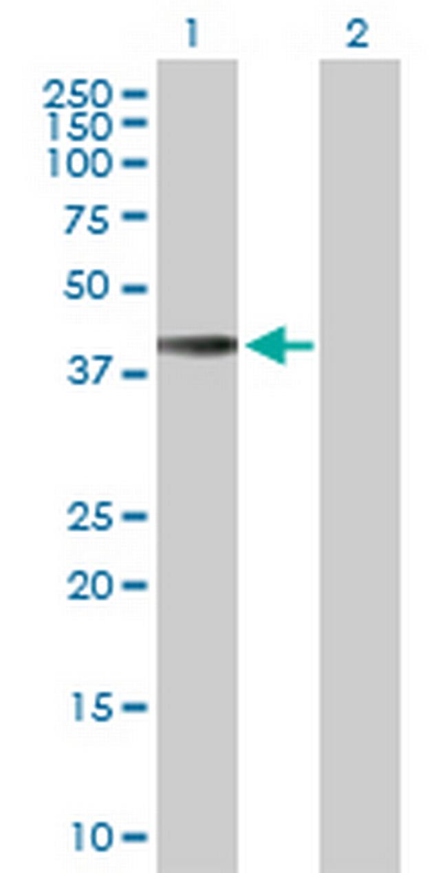 HLA-E Antibody in Western Blot (WB)