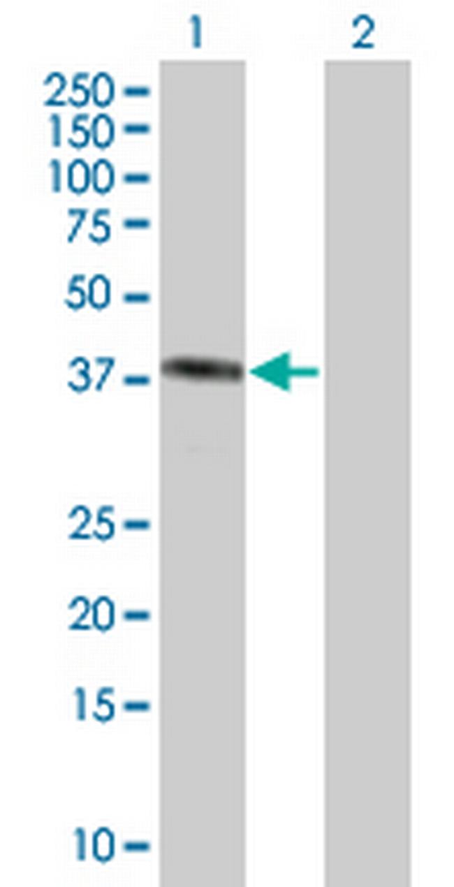 HMBS Antibody in Western Blot (WB)