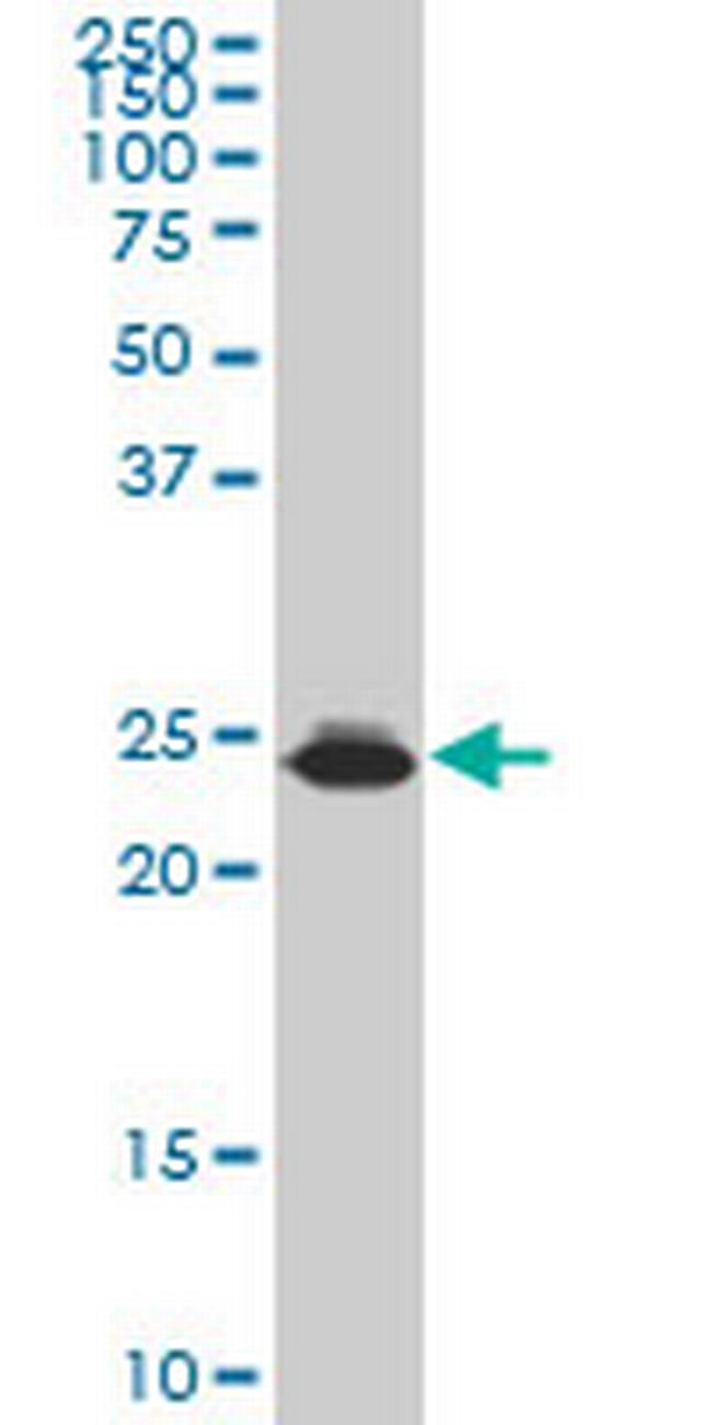 HMGB2 Antibody in Western Blot (WB)